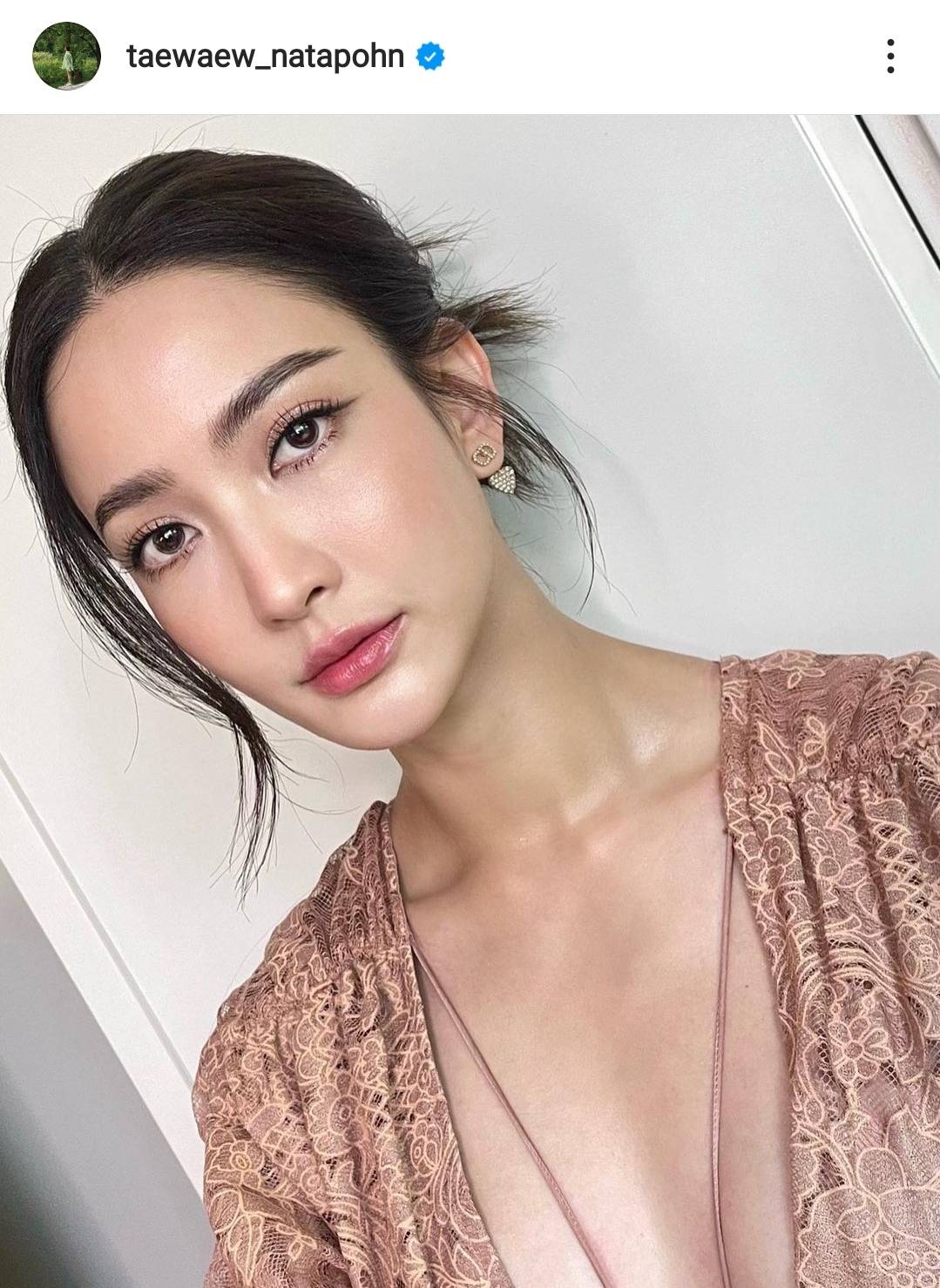 แต้ว ณฐพร แอดมิทโรงพยาบาล 4วัน หลังป่วยเป็นอหิวาตกโรค แต้ว ณฐพร แอดมิทโรงพยาบาล 4วัน หลังป่วยเป็นอหิวาตกโรค