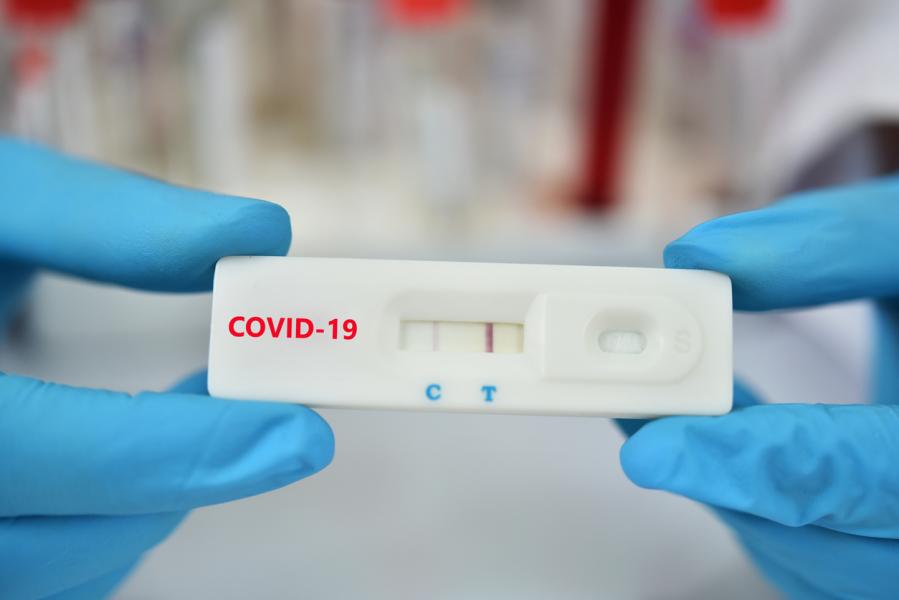 รู้จัก Rapid Antigen Test ชุดตรวจโควิดแบบเร่งด่วน รู้ผลเร็วภายใน 15 นาที