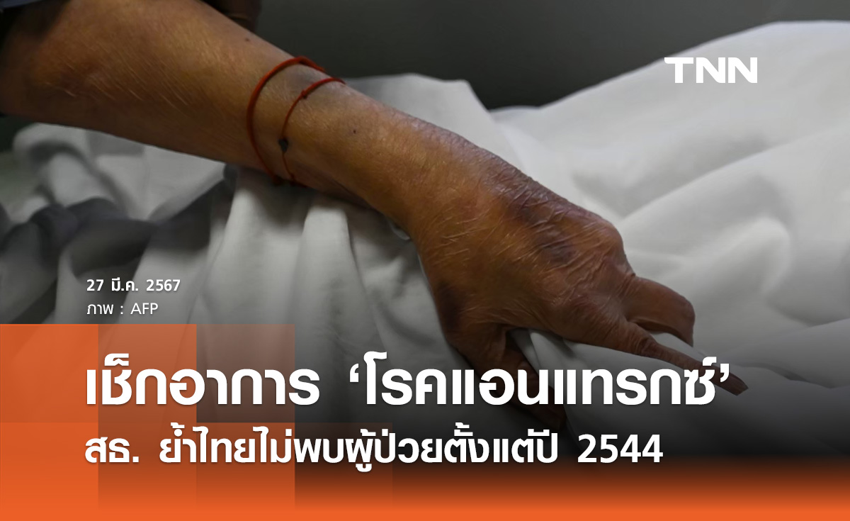 โรคแอนแทรกซ์! สธ. ย้ำไทยไม่พบผู้ป่วยตั้งแต่ปี 2544 เช็กอาการของโรคที่นี่