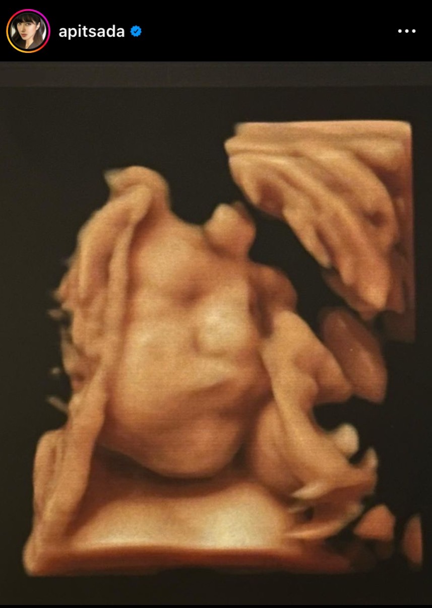 ไอซ์ อภิษฎา ตื่นเต้น จะได้เห็นหน้าลูกสาวแล้ว พร้อมถาม FC ว่าชื่ออะไรดี? ไอซ์ อภิษฎา ตื่นเต้น จะได้เห็นหน้าลูกสาวแล้ว พร้อมถาม FC ว่าชื่ออะไรดี?