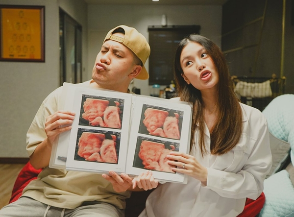 เป้ วงมายด์ เผยสาเหตุ ภรรยาท้องแก่ เข้าโรงพยาบาลกลางดึก