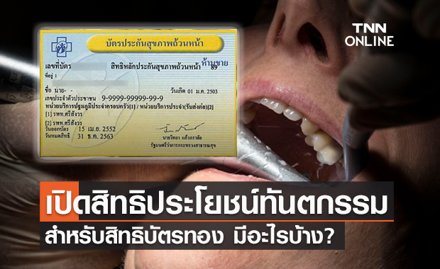 เปิดสิทธิประโยชน์ "ทำฟัน" บัตรทอง เพิ่มคุณภาพชีวิตทุกกลุ่มวัย