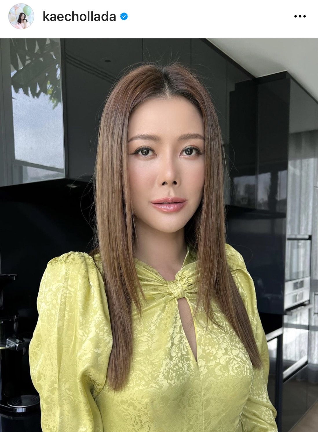 ติดโควิด!! เก๋ ชลลดา ยกเลิกงานด่วน ด้าน ปุ๊ อัญชลี กักตัวที่โรงพยาบาล โชคดีเชื้อไม่ลงปอด ติดโควิด!! เก๋ ชลลดา ยกเลิกงานด่วน ด้าน ปุ๊ อัญชลี กักตัวที่โรงพยาบาล โชคดีเชื้อไม่ลงปอด