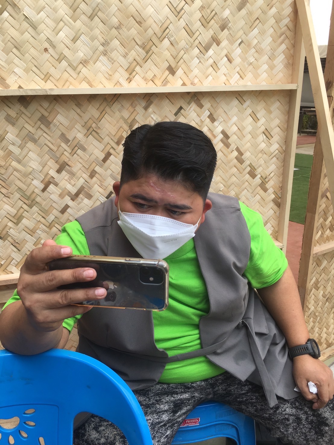 โก๊ะตี๋ เกิดอุบัติเหตุ หน้าผากพุพอง จากโดนฝาซึ้งร้อน ๆขณะถ่ายรายการ