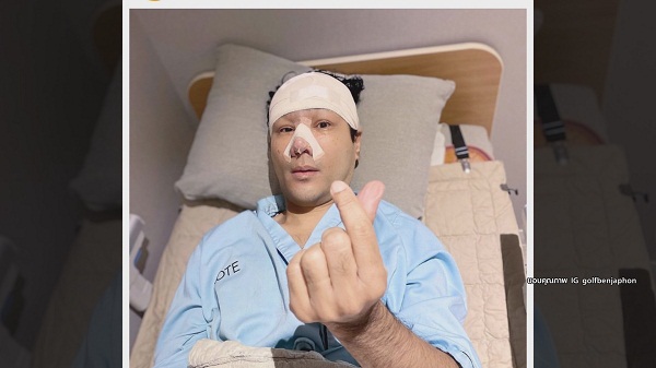 “กอล์ฟ เบญจพล” แฮปปี้ บินทำจมูกใหม่ที่เกาหลี  (มีคลิป) 