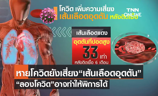 (คลิป)หายโควิดยังเสี่ยง“เส้นเลือดอุดตัน” “ลองโควิด”อาจทำให้พิการได้