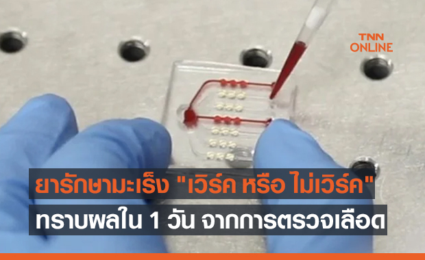 ยารักษามะเร็ง "เวิร์ค หรือ ไม่เวิร์ค" ทราบผลได้อย่างรวดเร็วใน 24 ชั่วโมงด้วยผลตรวจเลือด