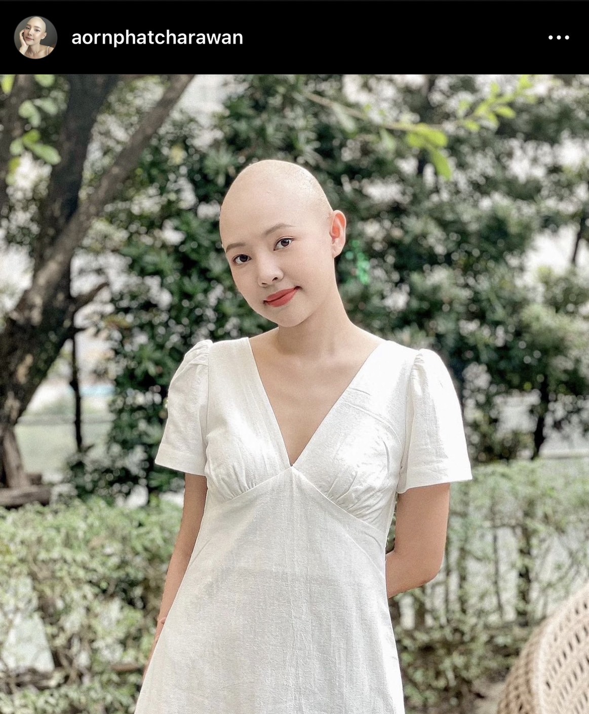 ออน พัชรวรรณ ประกาศข่าวดี หายขาดจากโรคมะเร็งต่อมน้ำเหลืองแล้ว ออน พัชรวรรณ ประกาศข่าวดี หายขาดจากโรคมะเร็งต่อมน้ำเหลืองแล้ว