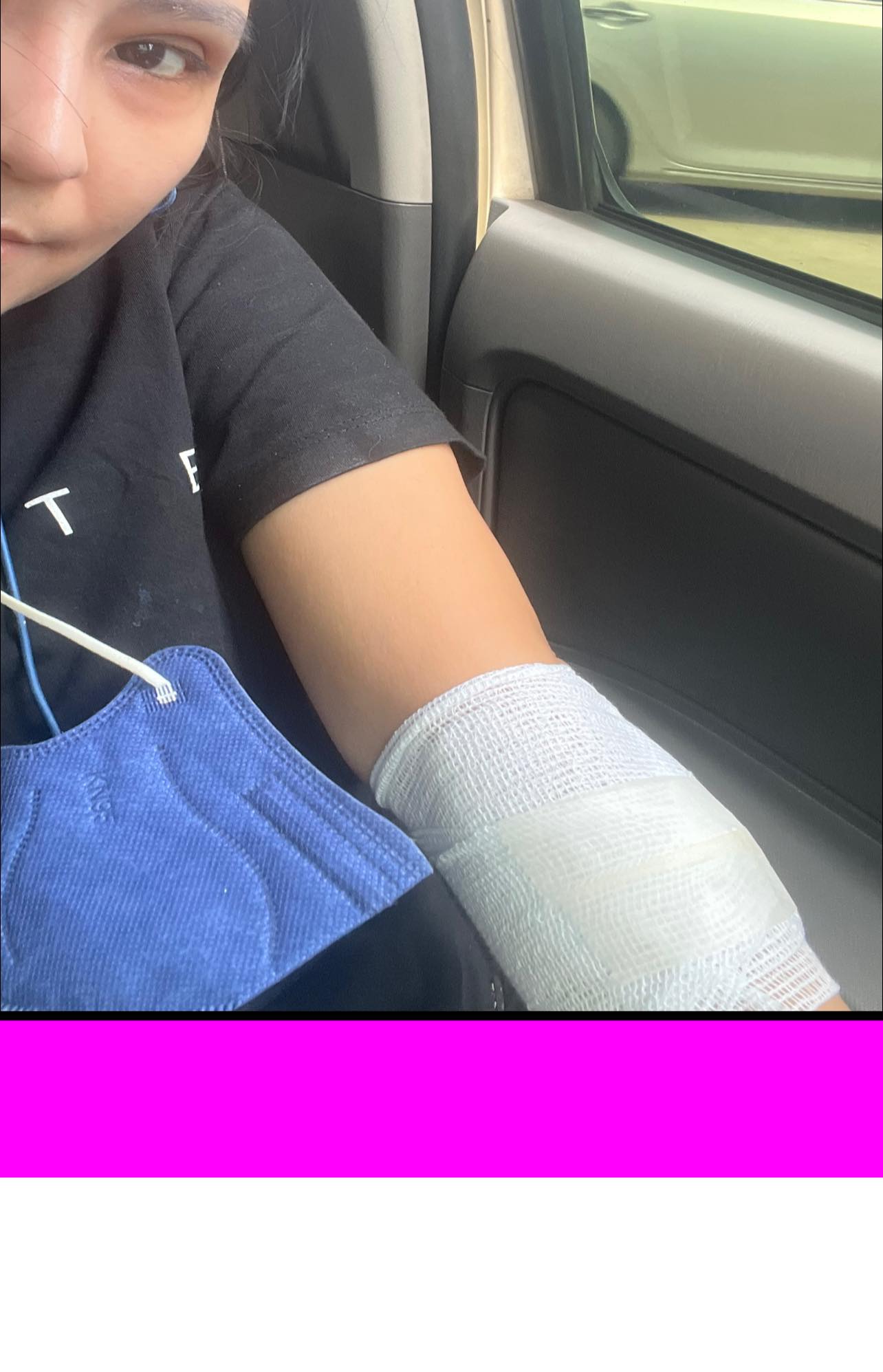 อดีตนักร้องดัง โรสแมรี่ ถูกรถชนแล้วหนี พร้อมเผยอาการบาดเจ็บ อดีตนักร้องดัง โรสแมรี่ ถูกรถชนแล้วหนี พร้อมเผยอาการบาดเจ็บ