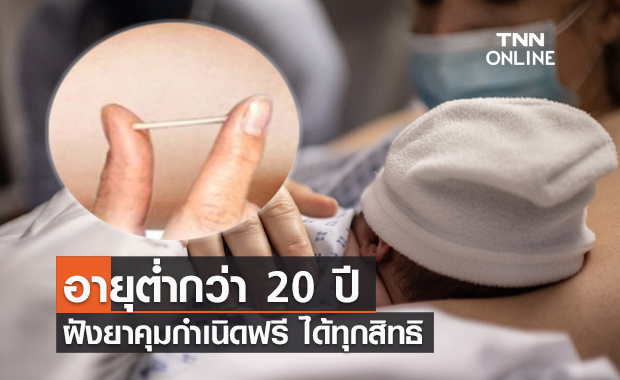 วัยรุ่น อายุต่ำกว่า 20 ปี "ฝังยาคุมกำเนิด-ห่วงอนามัย" ฟรีได้ทุกสิทธิ