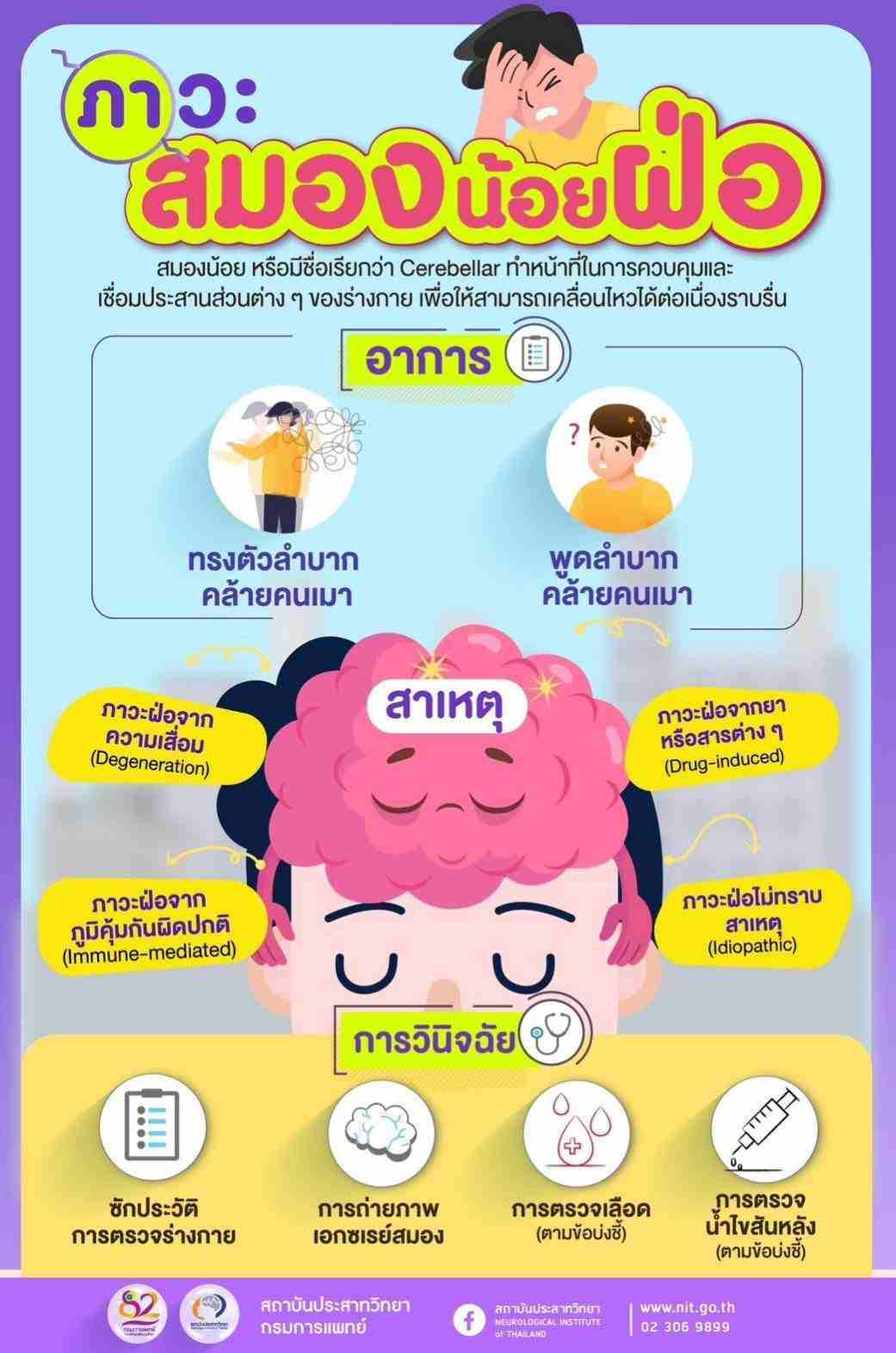 ภาวะสมองน้อยฝ่อ ทรงตัว-พูดลำบาก อาการคล้ายคนเมา