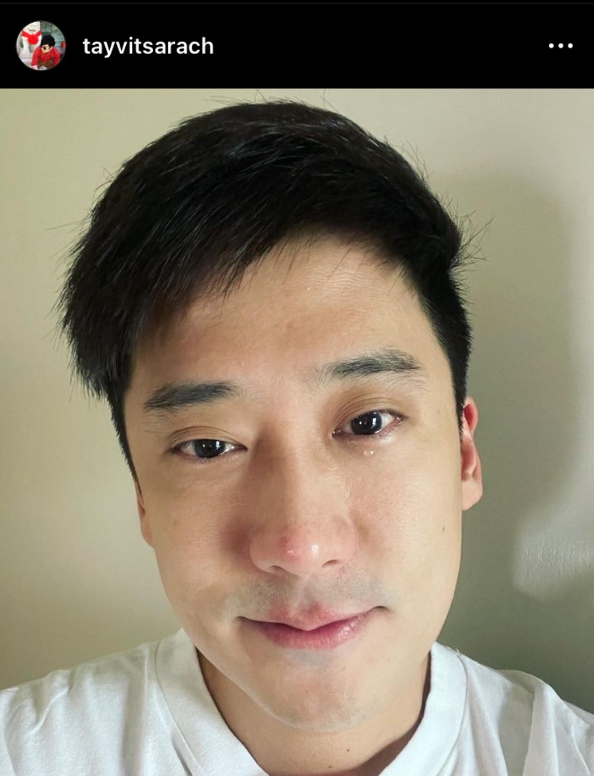 เต้ วิทย์สรัช ป่วยรับปีใหม่ เป็นโรค CSC จอประสาทตาบวม เต้ วิทย์สรัช ป่วยรับปีใหม่ เป็นโรค CSC จอประสาทตาบวม