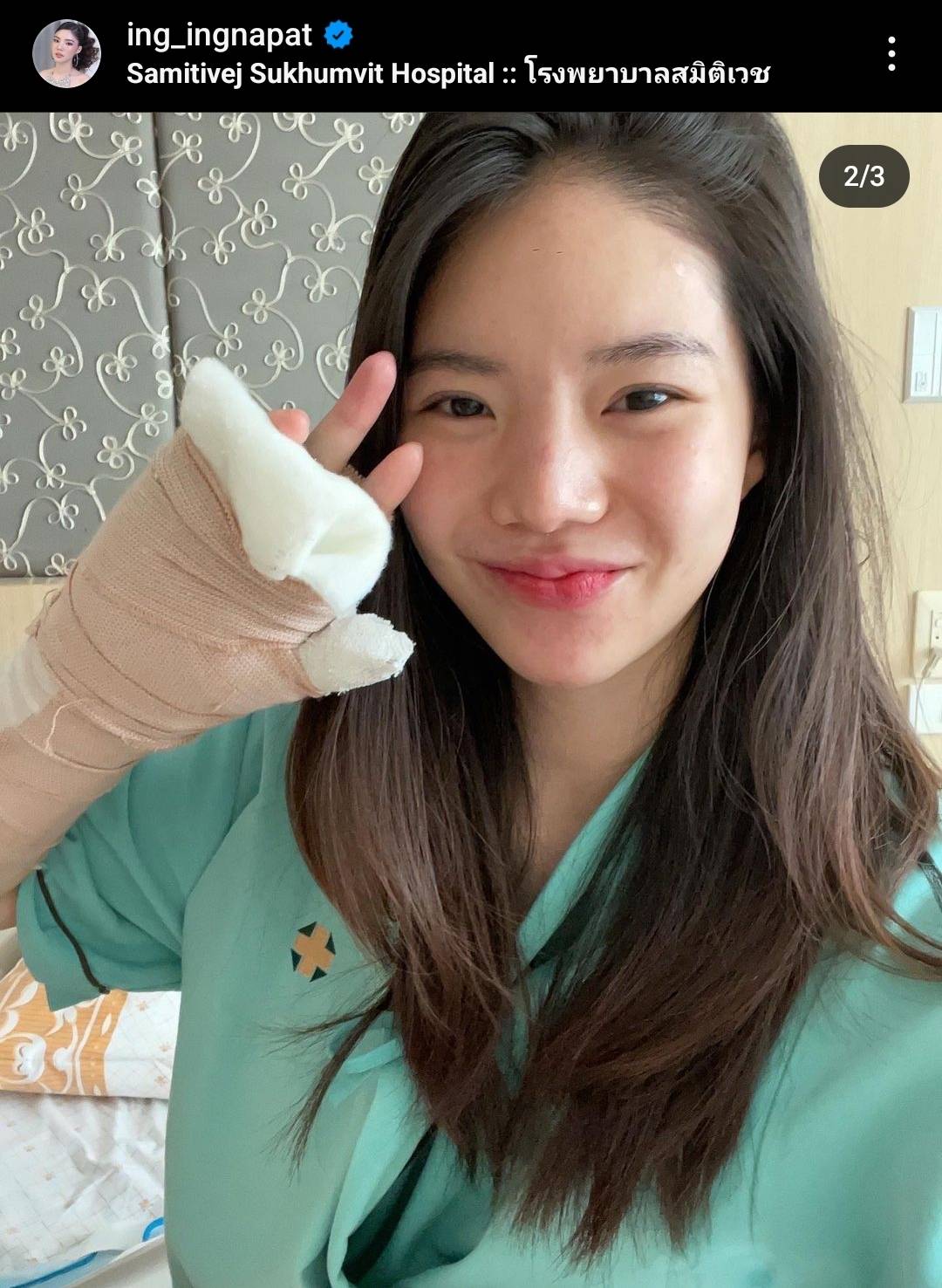 แฟนคลับห่วง อิงอิง อิงณภัสร์ ข้อมือหักหลังประสบอุบัติเหตุรถยนต์ เพราะโรคประจำตัวกำเริบ
