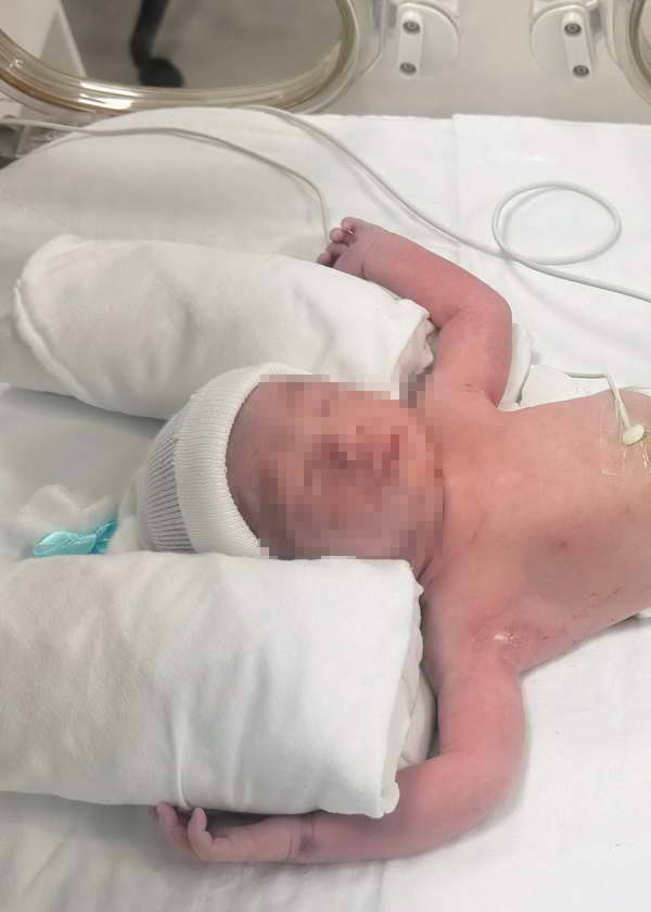 ครูเต้ย อภิวัฒน์ เปิดตัวลูกชาย น้องเติมเต็ม คลอดก่อนกำหนด ต้องเข้าตู้อบชั่วคราว ครูเต้ย อภิวัฒน์ เปิดตัวลูกชาย น้องเติมเต็ม คลอดก่อนกำหนด ต้องเข้าตู้อบชั่วคราว