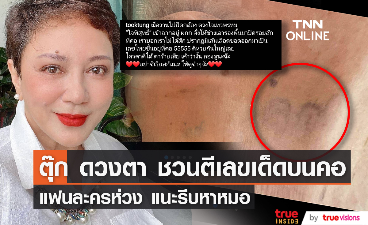 ตุ๊ก ดวงตา ชวนตีเลขเด็ดบนคอ แฟนละครห่วง แนะรีบหาหมอ