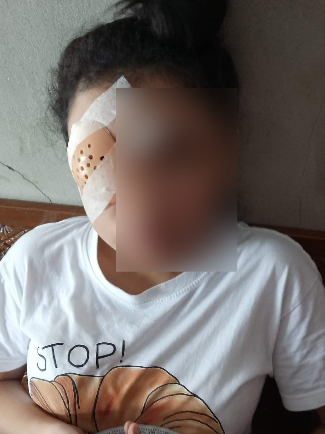 แม่โพสต์อุทาหรณ์! ลูกสาวเรียนออนไลน์-เล่นโทรศัพท์ เลือดออกในตา