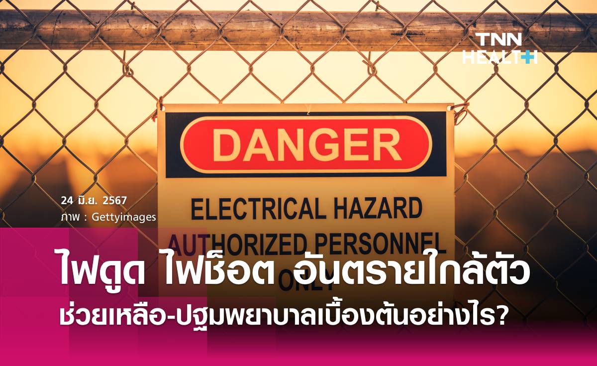 ไฟดูด ไฟช็อต ช่วยเหลือและปฐมพยาบาลเบื้องต้นอย่างไร?