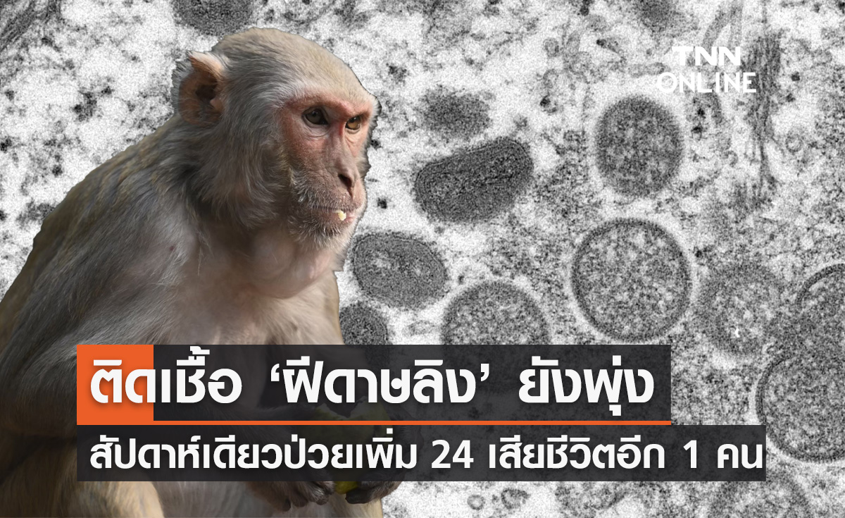 ฝีดาษลิง ยอดพุ่ง! สัปดาห์เดียวติดเชื้อเพิ่ม 24 ราย เสียชีวิตอีก 1 ราย 