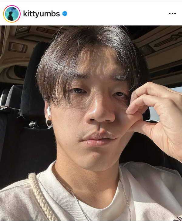 กิต Three Man Down พักงานด่วน! จอประสาทตาอักเสบ สูญเสียการมองเห็น กิต Three Man Down พักงานด่วน! จอประสาทตาอักเสบ สูญเสียการมองเห็น