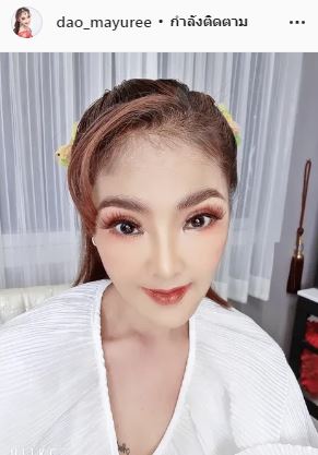 โดนบูลลี่หนัก ดาว มยุรี เจอพิษศัลยกรรม ใช้เวลากว่า 20 ปี แก้หน้าตัวเอง