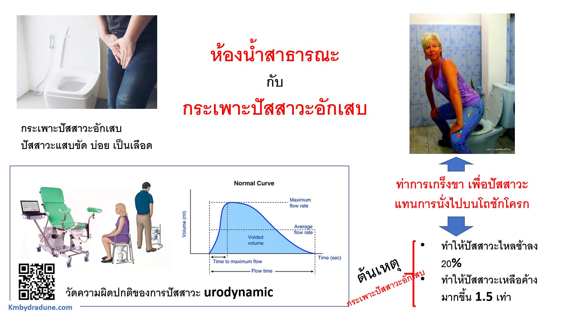 ห้องน้ำสาธารณะแล้วกระเพาะปัสสาวะอักเสบ ห้องน้ำสาธารณะแล้วกระเพาะปัสสาวะอักเสบ