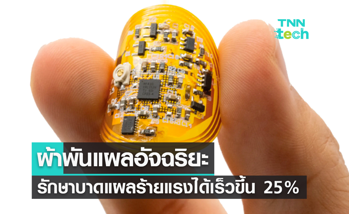 ผ้าพันแผลอัจฉริยะ รักษาบาดแผลร้ายแรงได้เร็วขึ้น 25%
