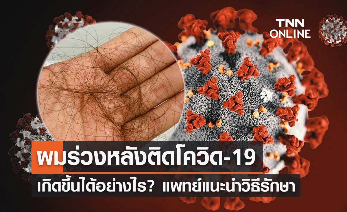 ผมร่วงหลังติดโควิด เกิดขึ้นได้อย่างไร? แพทย์ผิวหนังแนะนำวิธีรักษา