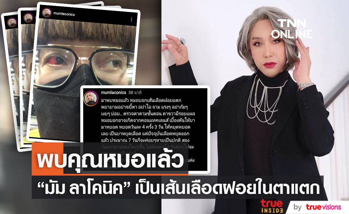 "มัม ลาโคนิค" พบคุณหมอแล้ว ยืนยัน เป็นเส้นเลือดฝอยในตาแตก