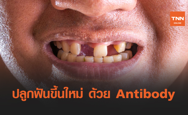 ปลูกฟันแท้ขึ้นใหม่ ไม่กลัวฟันหลออีกต่อไปด้วย "แอนติบอดี"