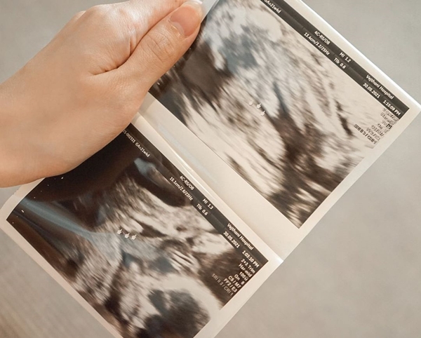  เปิดใจ  เป้ วงมายด์ ยอมรับกังวลภรรยาคลอดก่อนกำหนด