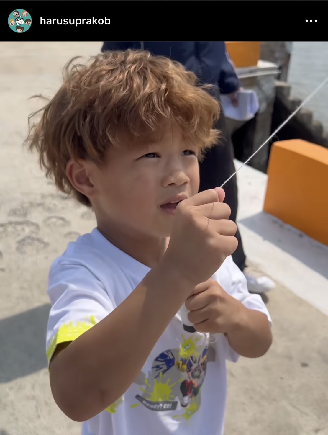 ร่วมส่งกำลังใจ กาย รัชชานนท์ ผ่าตัดกระดูกข้อมือและเส้นเอ็น ร่วมส่งกำลังใจ กาย รัชชานนท์ ผ่าตัดกระดูกข้อมือและเส้นเอ็น