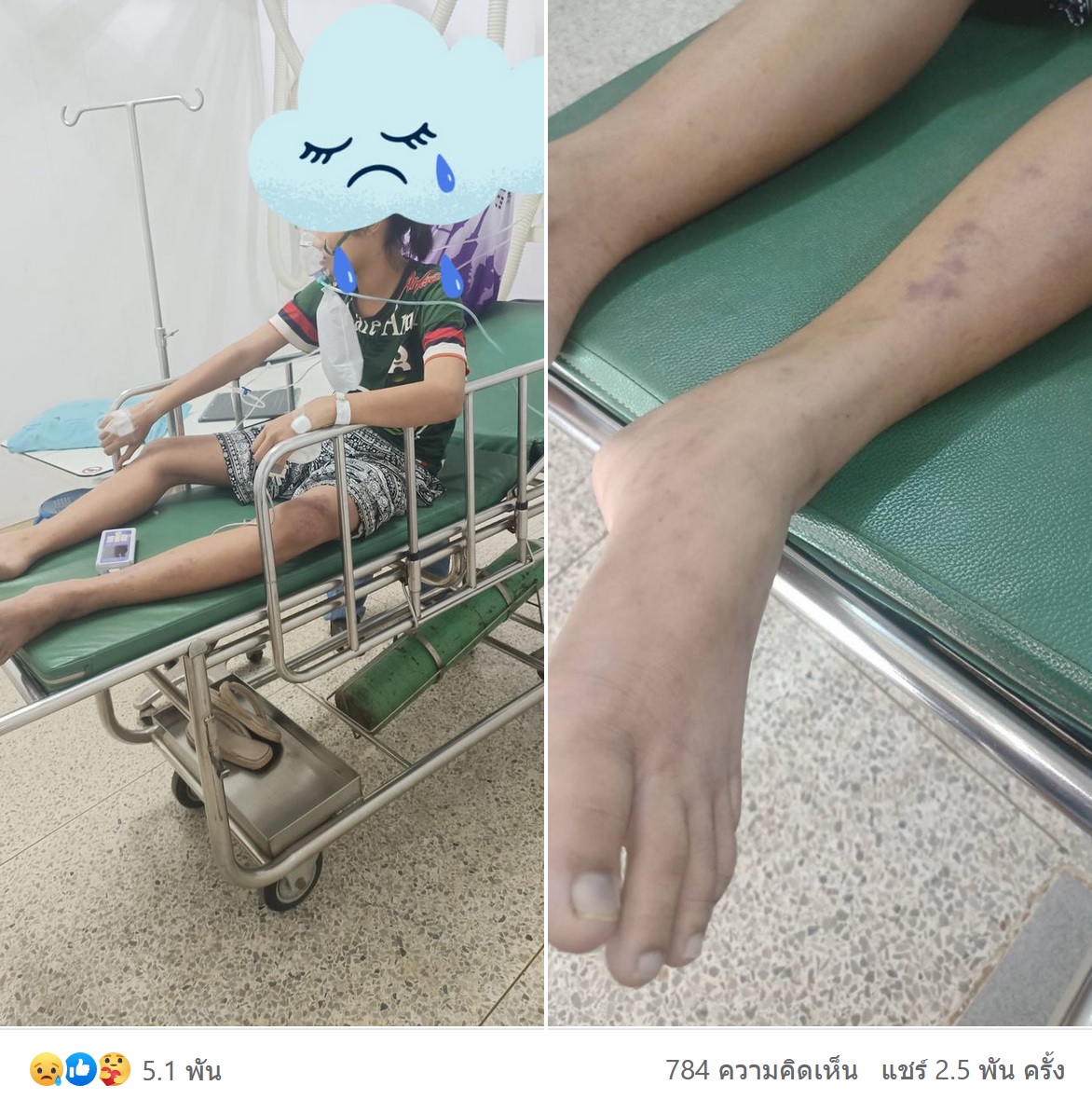 แม่โพสต์อุทาหรณ์! ลูกปวดขาหลังสอบวิชาพละ สุดท้ายเสียชีวิต แม่โพสต์อุทาหรณ์! ลูกปวดขาหลังสอบวิชาพละ สุดท้ายเสียชีวิต