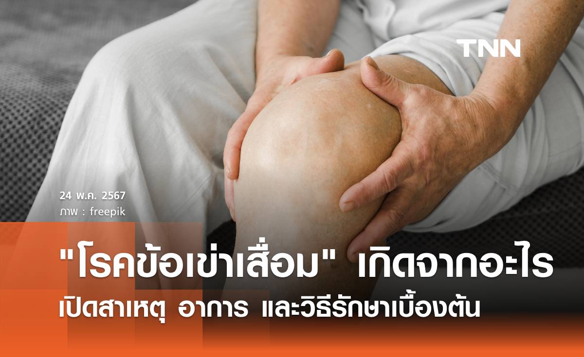 "โรคข้อเข่าเสื่อม" เกิดจากอะไร เปิดสาเหตุ อาการ และวิธีรักษาเบื้องต้น