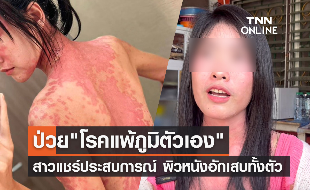 แคดดี้สาวแชร์ประสบการณ์ป่วย "โรคแพ้ภูมิตัวเอง" แนะใช้ชีวิตอย่างมีสติ