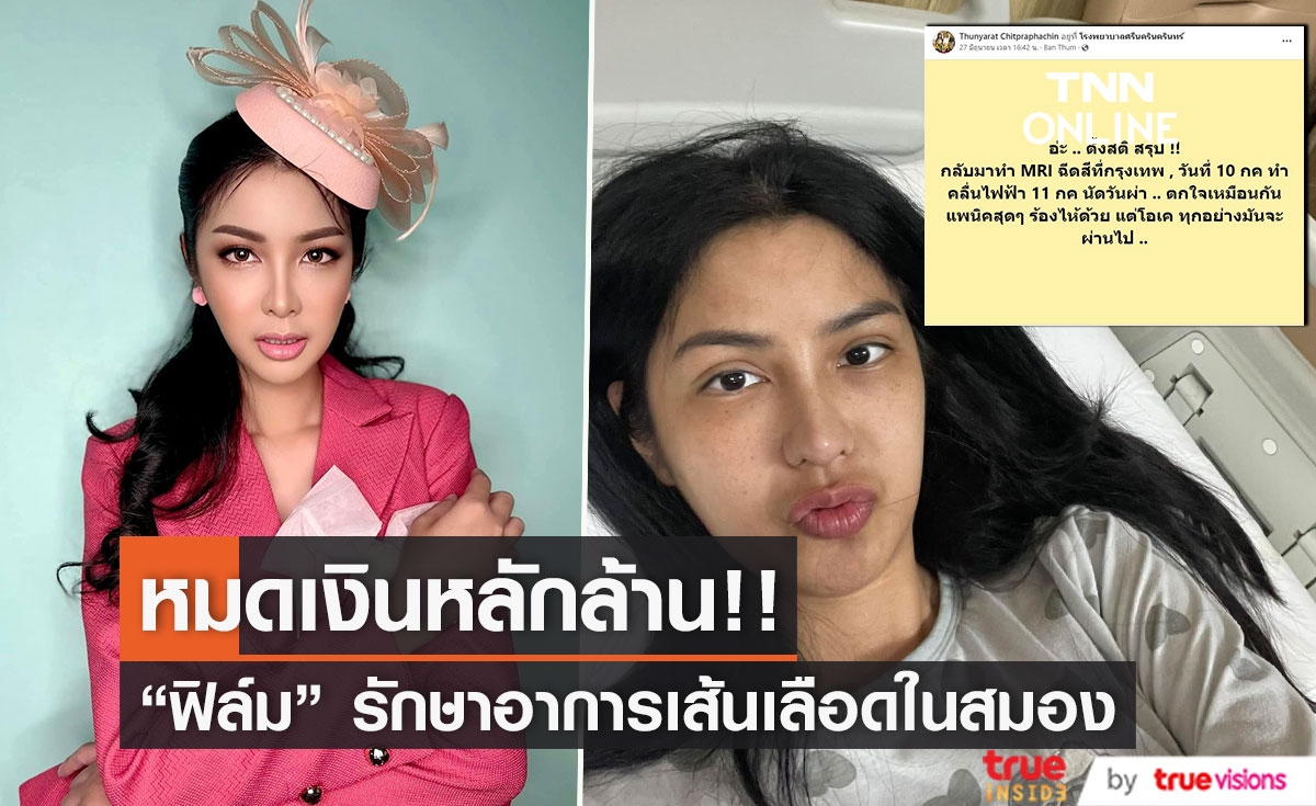 "ฟิล์ม มิสทิฟฟานี่" หมดเงินหลักล้าน!!  รักษาอาการเส้นเลือดในสมอง 