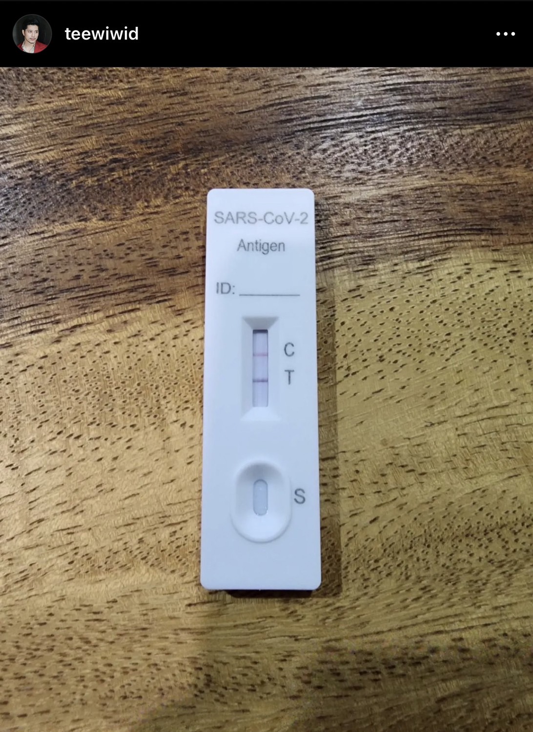 ซีซันนี้ไม่รอดแล้ว! ตี๋ วิวิศน์ ประกาศติดโควิด-19 ครั้งแรก ซีซันนี้ไม่รอดแล้ว! ตี๋ วิวิศน์ ประกาศติดโควิด-19 ครั้งแรก