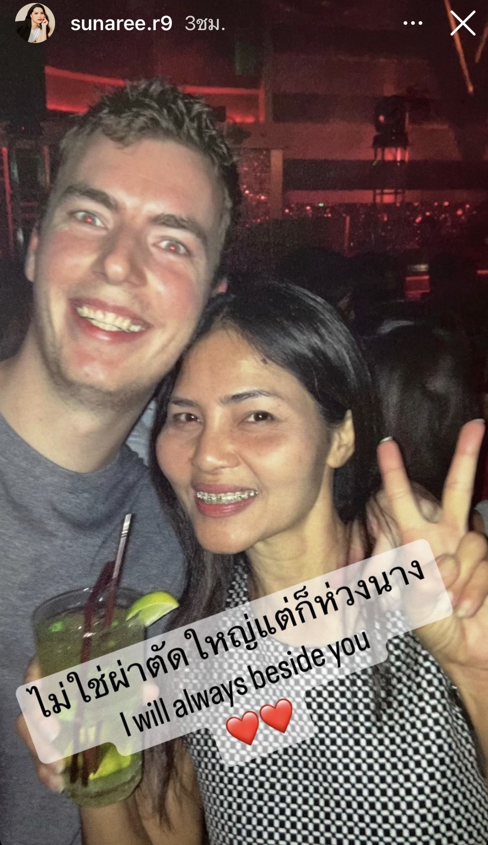 สุนารี ไม่กังวล แต่อดไม่ได้ เป็นห่วงสามี เข้ารับการผ่าตัด