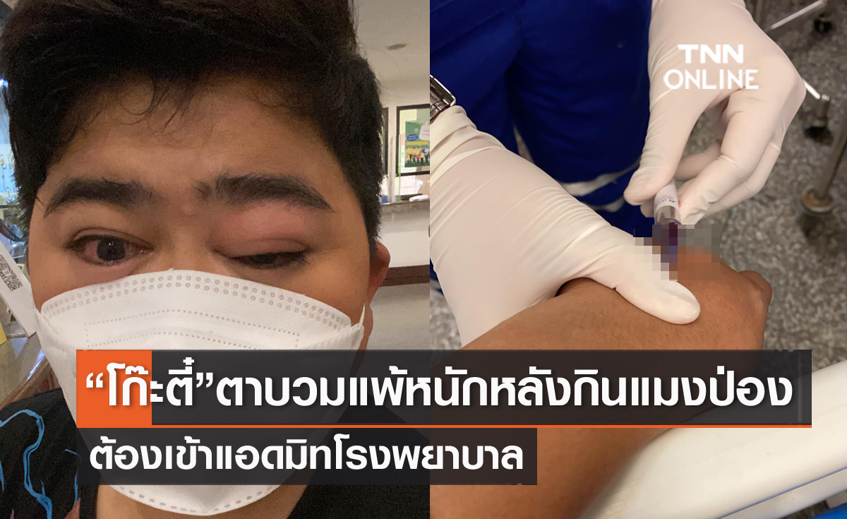 "โก๊ะตี๋" แพ้หนัก!! หลังกินแมงป่อง 3 ตัว ต้องแอดมิทรพ.