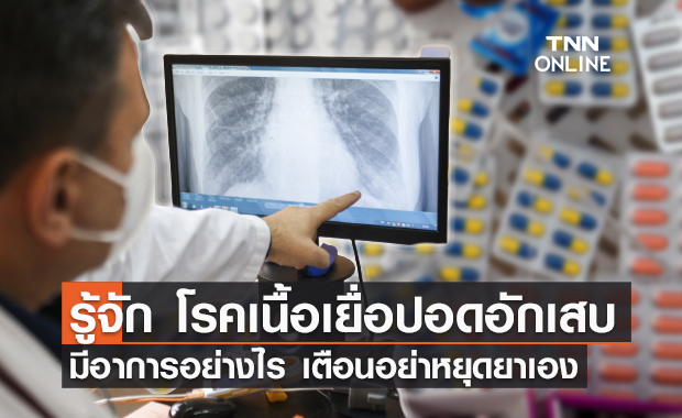 ทำความรู้จัก "โรคเนื้อเยื่อปอดอักเสบ" มีอาการอย่างไรบ้างเช็กเลย!