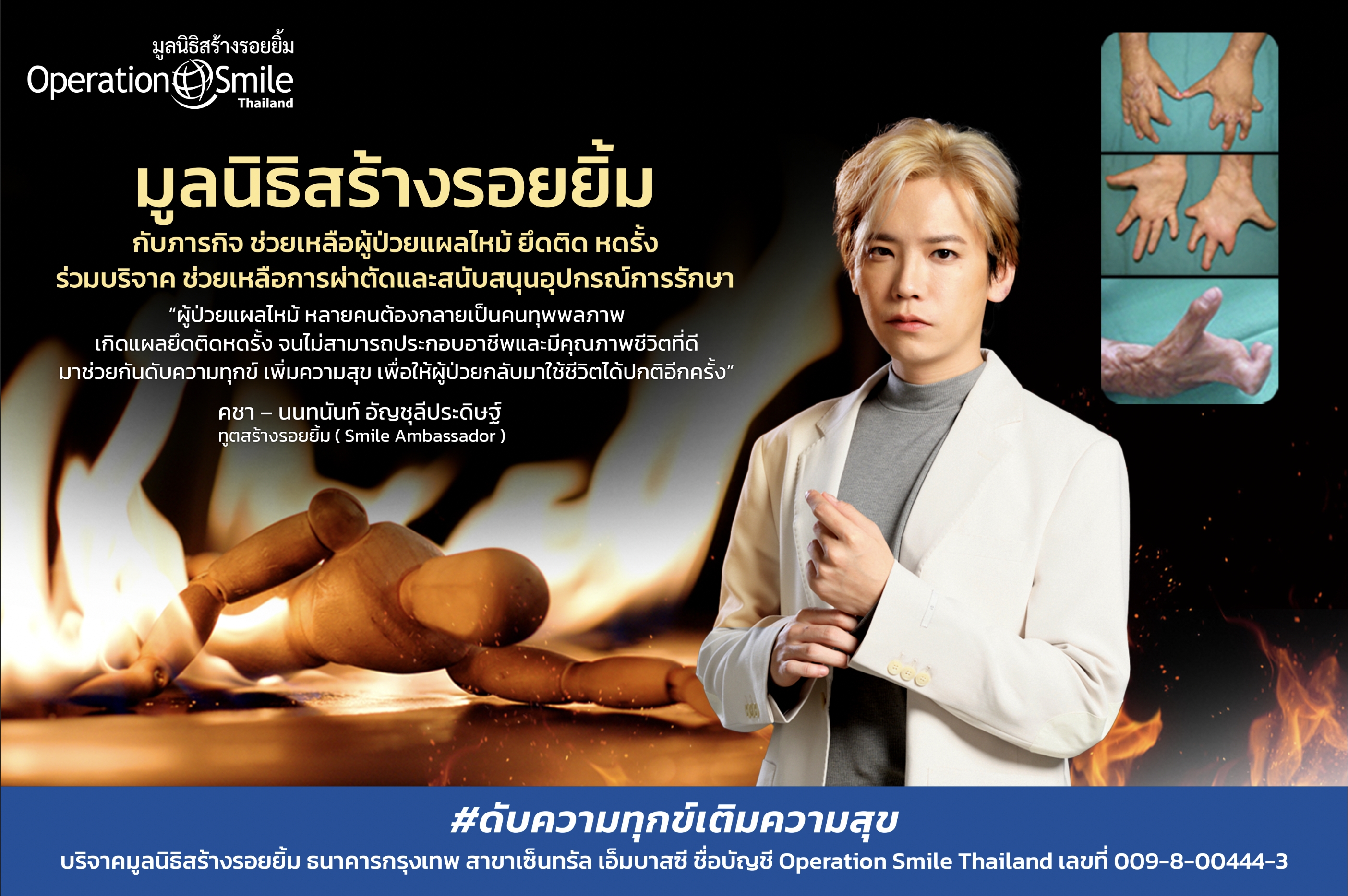 มูลนิธิสร้างรอยยิ้ม จับมือ เครือซีพี-กลุ่มทรู ชวนคนไทยร่วมบริจาคช่วยเหลือค่าผ่าตัดและอุปกรณ์รักษาให้ผู้ป่วยแผลไหม้ มูลนิธิสร้างรอยยิ้ม จับมือ เครือซีพี-กลุ่มทรู ชวนคนไทยร่วมบริจาคช่วยเหลือค่าผ่าตัดและอุปกรณ์รักษาให้ผู้ป่วยแผลไหม้