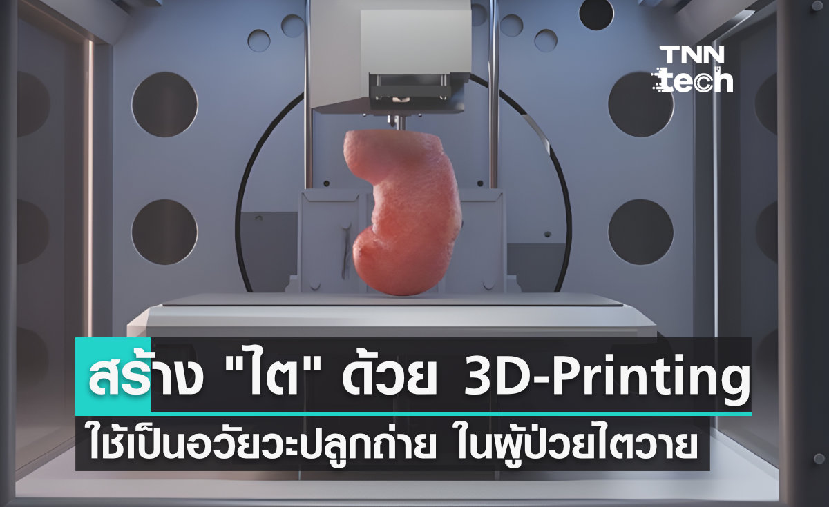 สร้าง "ไต" ด้วย 3D-printing เพื่อเป็นอวัยวะปลูกถ่ายแก่ผู้ป่วยไตวายเรื้อรัง