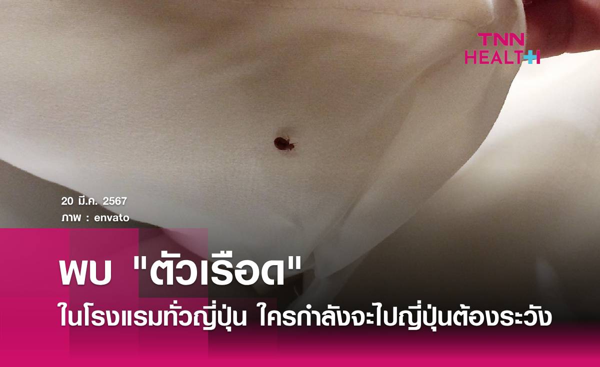 ใครกำลังจะไปญี่ปุ่นต้องระวัง รายงานพบเจอ "ตัวเรือด" ในโรงแรมทั่วญี่ปุ่น