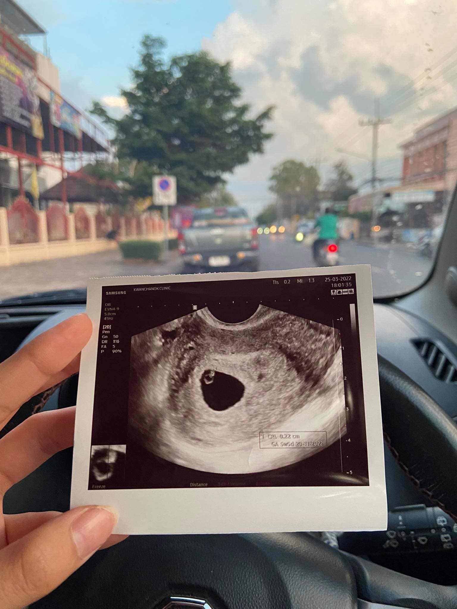 ด้งเด้ง ณัฐวุฒิ เป็นคุณพ่อป้ายแดง ภรรยาคลอดลูกชาย น้องฉลาม