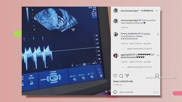 “ชมพู่ อารยา” เฉลยแล้วได้ลูกสาว  (มีคลิป)