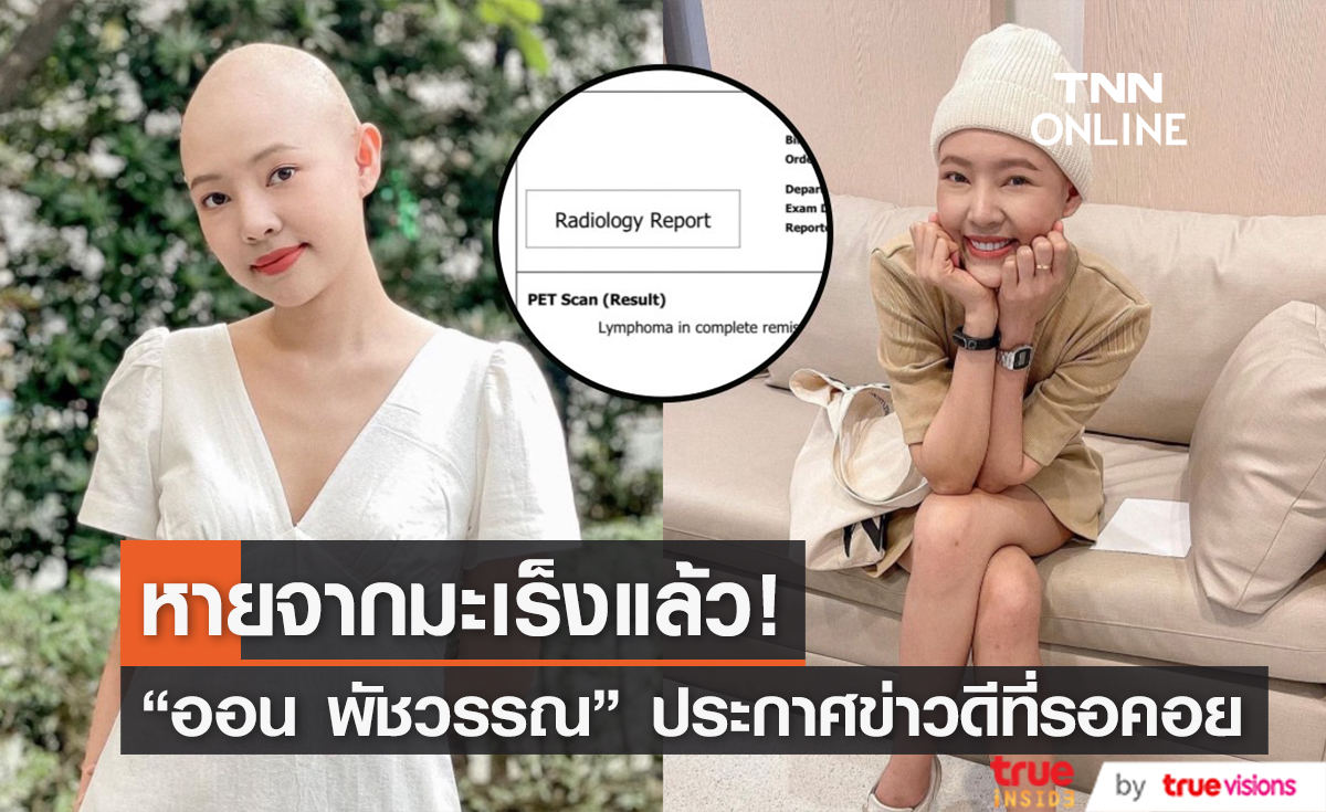 "ออน พัชรวรรณ" ประกาศข่าวดี หายขาดจากโรคมะเร็งต่อมน้ำเหลืองแล้ว