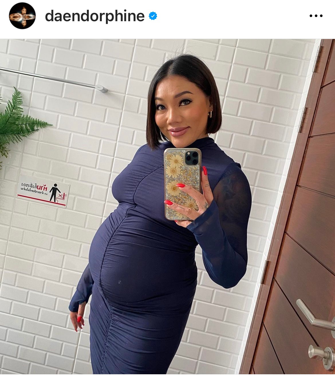 ดา เอ็นโดรฟิน ชวนทายเพศลูก คนบันเทิงและแฟนๆ แห่คอมเมนต์รัวๆ ดา เอ็นโดรฟิน ชวนทายเพศลูก คนบันเทิงและแฟนๆ แห่คอมเมนต์รัวๆ