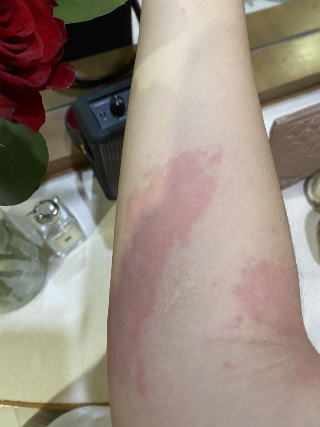 เเอ็ดมิทด่วน!! ฝ้าย สุภาพร เหตุเเพ้บาธบอมอย่างหนัก เเอ็ดมิทด่วน!! ฝ้าย สุภาพร เหตุเเพ้บาธบอมอย่างหนัก