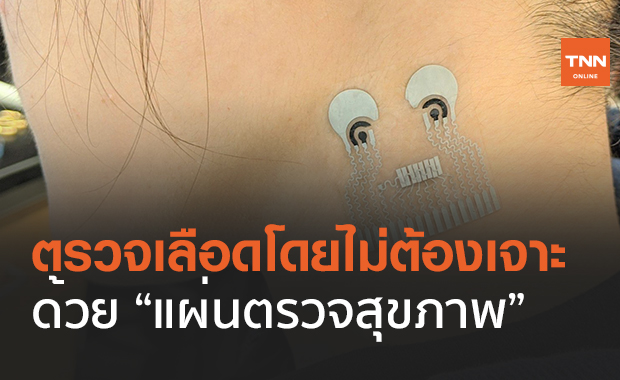 ตรวจเลือดโดยไม่ต้องเจาะ ด้วยแผ่นตรวจสุขภาพ