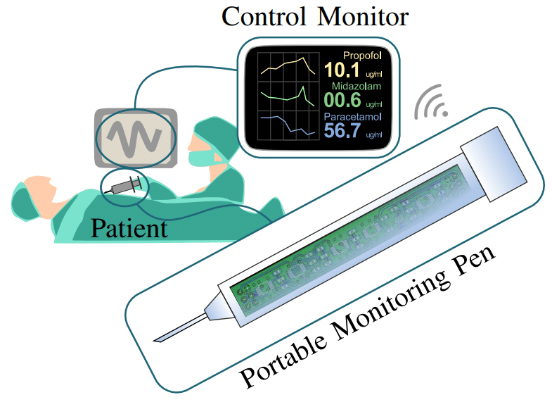 ปากกาอัจฉริยะ วัดระดับยาสลบอย่างแม่นยำในขณะผ่าตัด ปากกาอัจฉริยะ วัดระดับยาสลบอย่างแม่นยำในขณะผ่าตัด