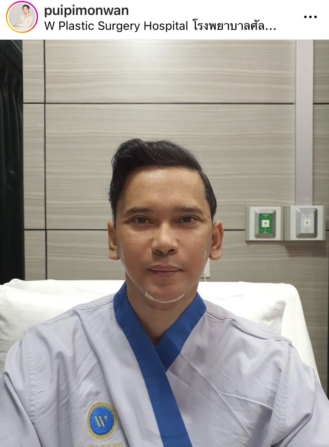 แมว จิรศักดิ์ ตอบสุดฮา หลังทำศัลยกรรมครั้งแรก บอกตัวเองชื่อ ณเดชน์